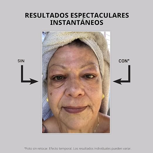 El problema